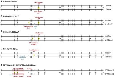 Functional Profiling of CFTR-Directed Therapeutics Using Pediatric Patient-Derived Nasal Epithelial Cell Models